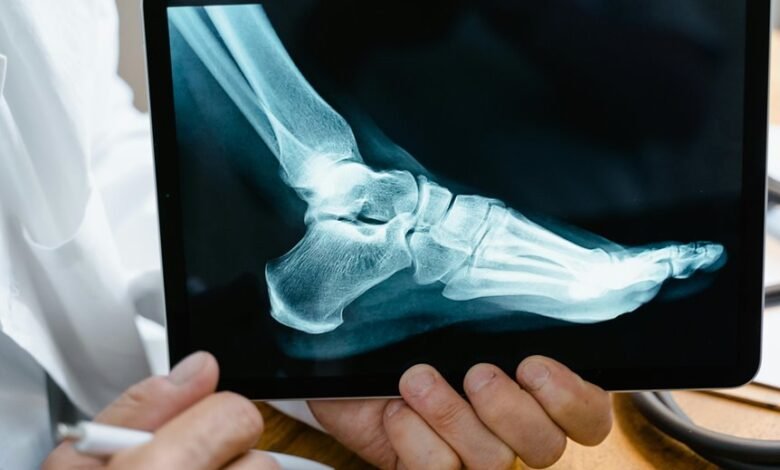 peak hour call analysis